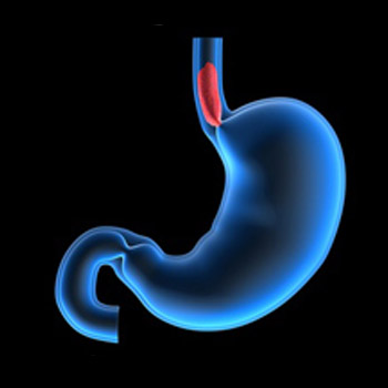 gastric-pic